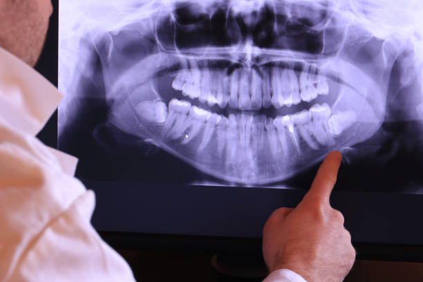 Best Chipped Tooth Repair Near Me  in Poinciana, FL